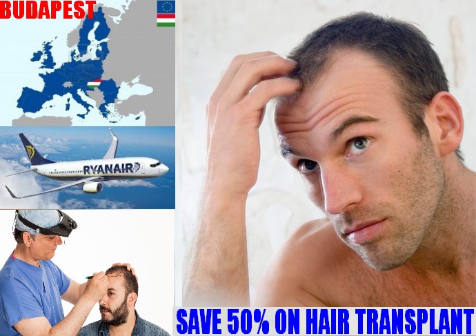 Hair transplant Budapest - 50% more affordable than in Manchester!